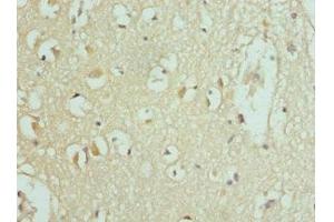 Immunohistochemistry of paraffin-embedded human brain tissue using ABIN7159841 at dilution of 1:100 (SLC25A2 anticorps  (AA 1-301))