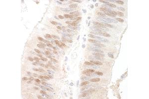 anti-Methyl-CpG Binding Domain Protein 3 (MBD3) (AA 265-291) antibody
