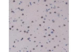 Used in DAB staining on fromalin fixed paraffin- embedded Kidney tissue (IL17RA anticorps  (AA 617-847))