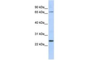 ZNF835 抗体  (AA 306-355)