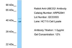 Western Blotting (WB) image for anti-Ubiquitin-Conjugating Enzyme E2Q Family Member 1 (UBE2Q1) (Middle Region) antibody (ABIN2789307) (UBE2Q1 anticorps  (Middle Region))