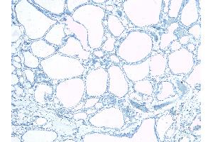 ABIN185487 Negative Control showing staining of paraffin embedded Human Thyroid Gland, with no primary antibody.