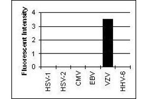 Cross Reactivity Results determined by IFA (Glycoprotein I anticorps)