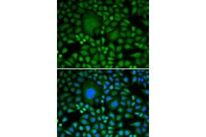 Immunofluorescence analysis of HeLa cells using DDX5 antibody. (DDX5 anticorps  (AA 1-614))