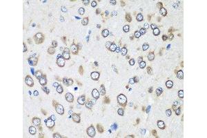 Immunohistochemistry of paraffin-embedded Rat brain using EEF1G Polyclonal Antibody at dilution of 1:100 (40x lens). (EEF1G anticorps)