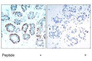 Image no. 1 for anti-BCL2-Like 11 (Apoptosis Facilitator) (BCL2L11) (Ser65) antibody (ABIN197552) (BIM anticorps  (Ser65))