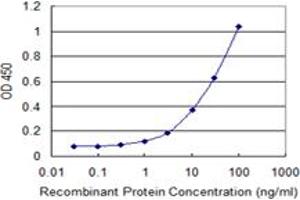 Detection limit for recombinant GST tagged MBD1 is 0.
