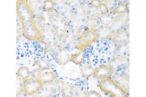 Immunohistochemistry of paraffin-embedded Mouse kidney using CEACAM7 Polyclonal Antibody at dilution of 1:100 (40x lens). (CEACAM7 anticorps)
