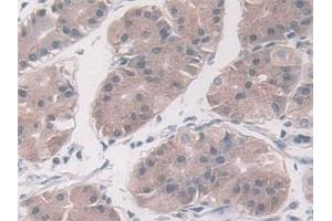 Detection of PAI1 in Human Stomach Tissue using Monoclonal Antibody to Plasminogen Activator Inhibitor 1 (PAI1)