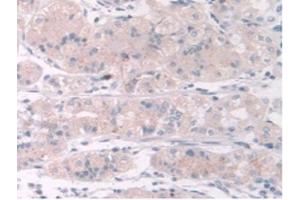 IHC-P analysis of Human Stomach Tissue, with DAB staining. (TPMT anticorps  (AA 26-227))