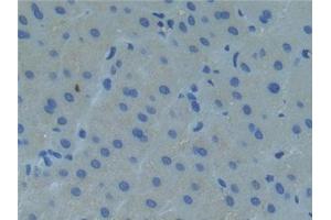 Detection of Raftlin in Human Liver Tissue using Polyclonal Antibody to Raft Linking Protein (Raftlin)