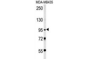 Western Blotting (WB) image for anti-Thyrotropin Releasing Hormone Degrading Enzyme (TRHDE) antibody (ABIN3002402) (TRHDE anticorps)