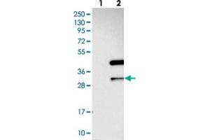 Western blot analysis of Lane 1: Negative control (vector only transfected HEK293T lysate), Lane 2: Over-expression Lysate (Co-expressed with a C-terminal myc-DDK tag (~3. (ANKRD23 anticorps)