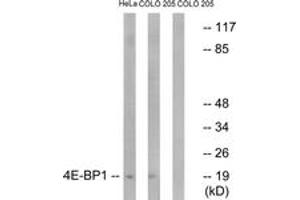 Western Blotting (WB) image for anti-Eukaryotic Translation Initiation Factor 4E Binding Protein 1 (EIF4EBP1) (AA 13-62) antibody (ABIN2888940) (eIF4EBP1 anticorps  (AA 13-62))