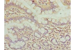 Immunohistochemistry of paraffin-embedded human small intestine tissue using ABIN7175786 at dilution of 1:100 (WDR66 anticorps  (AA 1-1154))