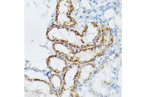 Immunohistochemistry of paraffin-embedded mouse kidney using ETHE1 antibody (ABIN6131616, ABIN6140319, ABIN6140320 and ABIN6214289) at dilution of 1:100 (40x lens).