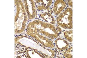 Immunohistochemistry of paraffin-embedded human kidney using PSEN2 antibody.