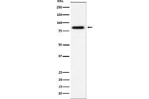 Western blot analysis of CD105 expression in HUVEC cell lysate.