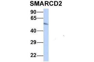 Host:  Rabbit  Target Name:  SMARCD2  Sample Type:  Human Fetal Heart  Antibody Dilution:  1. (SMARCD2 anticorps  (Middle Region))