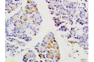 Formalin-fixed and paraffin embedded rat pancreas labeled with Anti-SGCB/SGC Polyclonal Antibody, Unconjugated  at 1:200 followed by conjugation to the secondary antibody and DAB staining. (SGCB anticorps  (AA 165-260))