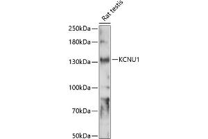 Western blot analysis of extracts of rat testis, using KCNU1 antibody (ABIN7269471) at 1:1000 dilution. (KCNU1 anticorps  (AA 920-1149))