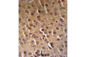 Immunohistochemistry (IHC) image for anti-Cyclin-Dependent Kinase 14 (CDK14) antibody (ABIN3002794)