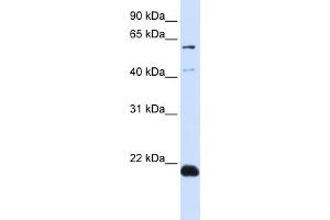 WB Suggested Anti-C14orf180 Antibody Titration:  0. (C14orf180 anticorps  (N-Term))