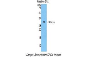Western Blotting (WB) image for anti-Glypican 4 (GPC4) (AA 261-527) antibody (ABIN1859055) (GPC4 anticorps  (AA 261-527))