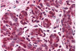 Human Breast: Formalin-Fixed, Paraffin-Embedded (FFPE)