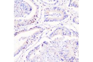IHC analysis of FHL using anti-FHL antibody (ABIN7600488). (FHL1 anticorps  (AA 2-323))