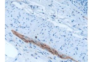 Used in DAB staining on fromalin fixed paraffin- embedded brain tissue (S100B anticorps  (AA 1-92))
