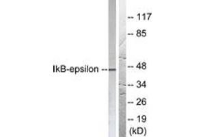 Western Blotting (WB) image for anti-Nuclear Factor of kappa Light Polypeptide Gene Enhancer in B-Cells Inhibitor, epsilon (NFKBIE) (AA 131-180) antibody (ABIN2888569) (NFKBIE anticorps  (AA 131-180))