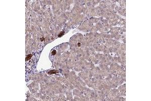 Immunohistochemical staining of human liver with RPS26 polyclonal antibody  shows strong cytoplasmic positivity in bile duct cells at 1:20-1:50 dilution. (RPS26 anticorps)