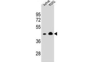 Western Blotting (WB) image for anti-Olfactory Receptor, Family 10, Subfamily A, Member 4 (OR10A4) antibody (ABIN2995885) (OR10A4 anticorps)
