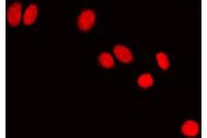 Immunofluorescent analysis of HP1 alpha staining in NIH3T3 cells.