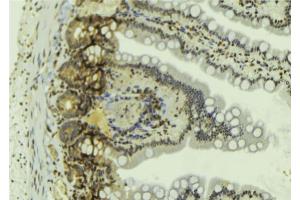 ABIN6269060 at 1/100 staining Mouse colon tissue by IHC-P.