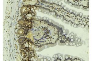 ABIN6269060 at 1/100 staining Mouse colon tissue by IHC-P. (JAK2 anticorps  (C-Term))