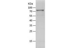 V-Akt Murine Thymoma Viral Oncogene Homolog 1 (AKT1) (AA 1-480) protein (His-IF2DI Tag)