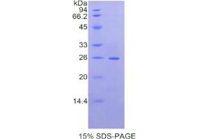 SDS-PAGE analysis of Mouse Laminin beta 2 Protein. (LAMB2 Protéine)