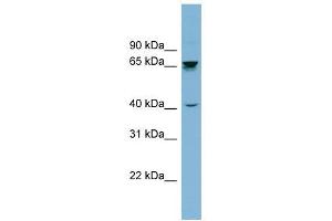 AChE antibody used at 1 ug/ml to detect target protein. (Acetylcholinesterase anticorps)