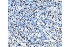Immunohistochemistry of paraffin-embedded Human appendix using ITGB3BP Polyclonal Antibody at dilution of 1:100 (40x lens).