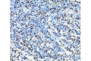 Immunohistochemistry of paraffin-embedded Human appendix using ITGB3BP Polyclonal Antibody at dilution of 1:100 (40x lens). (ITGB3BP anticorps)