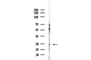 anti-Protein Phosphatase 4, Catalytic Subunit (PPP4C) (C-Term) antibody