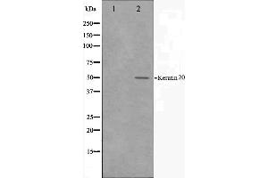 Western blot analysis on HeLa cell lysate using Keratin 20 Antibody.