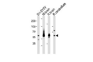 Western blot analysis of lysates from SH-SY5Y cell line, mouse brain, rat brain, rat cerebellum tissue (from left to right), using SYN1 Antibody (C-term) (ABIN1881860 and ABIN2843335).