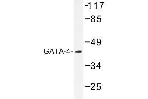 Image no. 2 for anti-GATA Binding Protein 4 (GATA4) antibody (ABIN272192) (GATA4 anticorps)