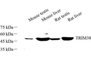 Western blot analysis of TRIM38 (ABIN7076019) at dilution of 1: 500 (TRIM38 anticorps)
