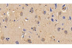 Detection of TNFa in Bovine Cerebrum Tissue using Polyclonal Antibody to Tumor Necrosis Factor Alpha (TNFa)