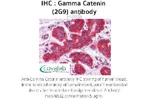 Image no. 1 for anti-Junction Plakoglobin (JUP) (AA 1-746), (full length) antibody (ABIN1723489) (JUP anticorps  (full length))