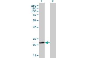 Western Blot analysis of ISOC2 expression in transfected 293T cell line by ISOC2 MaxPab polyclonal antibody. (ISOC2 anticorps  (AA 1-205))
